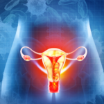 Ovarian Tumor Marker